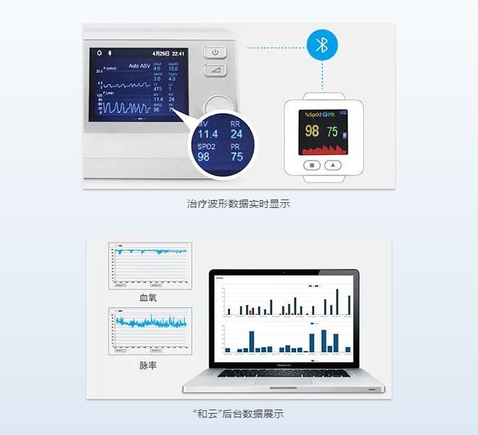 和普乐CA820M睡眠呼吸机(图4)