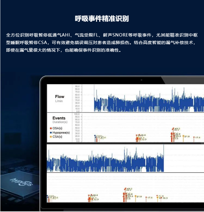 和普乐CA820M睡眠呼吸机(图7)
